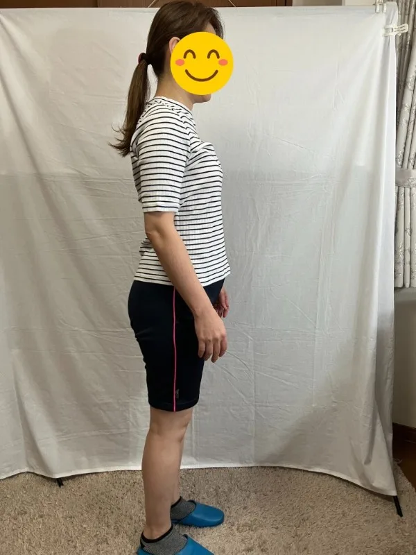 足のむくみもスッキリしました！ アフター