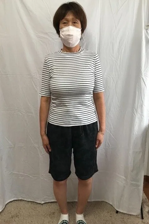 お腹周りも見違えるほどスッキリ！ アフター
