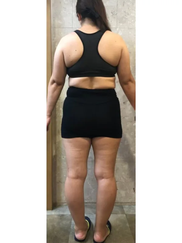 耳ツボダイエットが唯一痩せた！ ビフォー