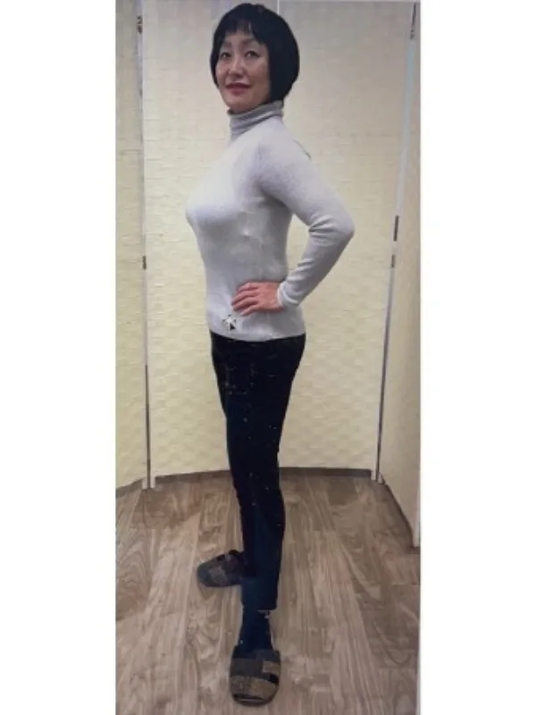 耳ツボダイエットで減量に成功! アフター