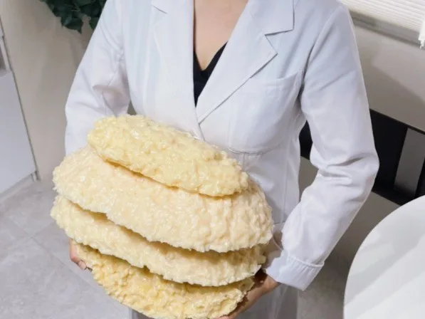 耳つぼダイエットサロンcharmy