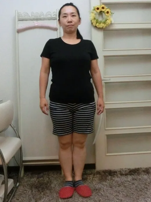 階段の登り下りも楽々になった！ ビフォー