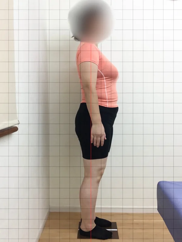 思い通りに痩せられて良かった！ ビフォー