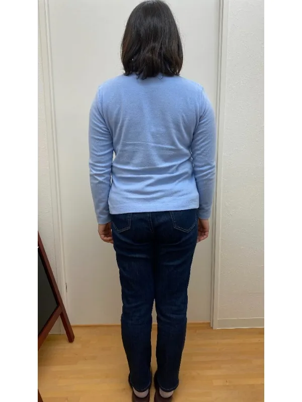 久々に会った友だちに驚かれました！ ビフォー