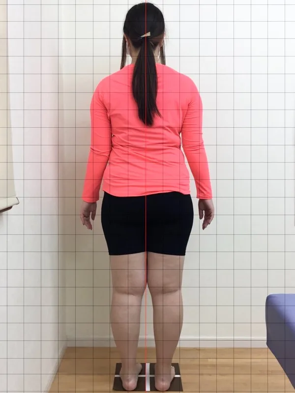 諦めかけていたが、やってよかった！ ビフォー