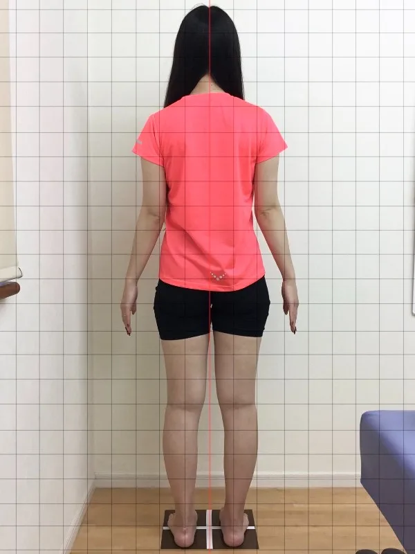 諦めかけていたが、やってよかった！ アフター