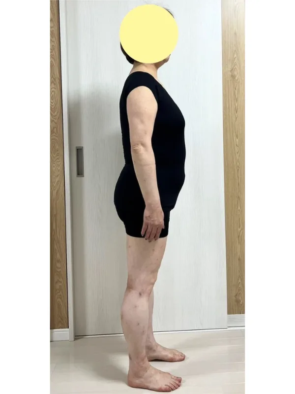 大幅ダイエットで全身スッキリ！ ビフォー