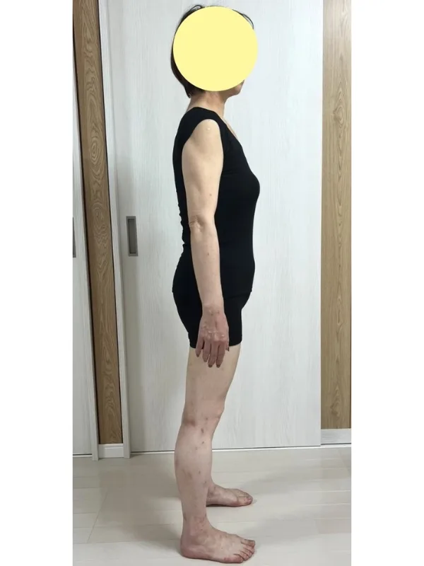 大幅ダイエットで全身スッキリ！ アフター