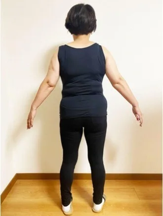 痩せておしゃれが楽しくなった！ ビフォー