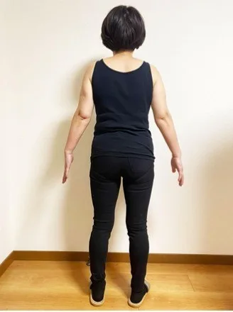 痩せておしゃれが楽しくなった！ アフター