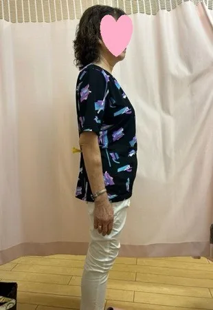 年齢に関係なくきれいに痩せた！ アフター