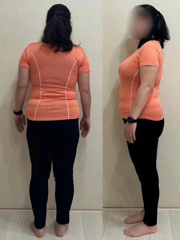 運動もできるようになりました! ビフォー