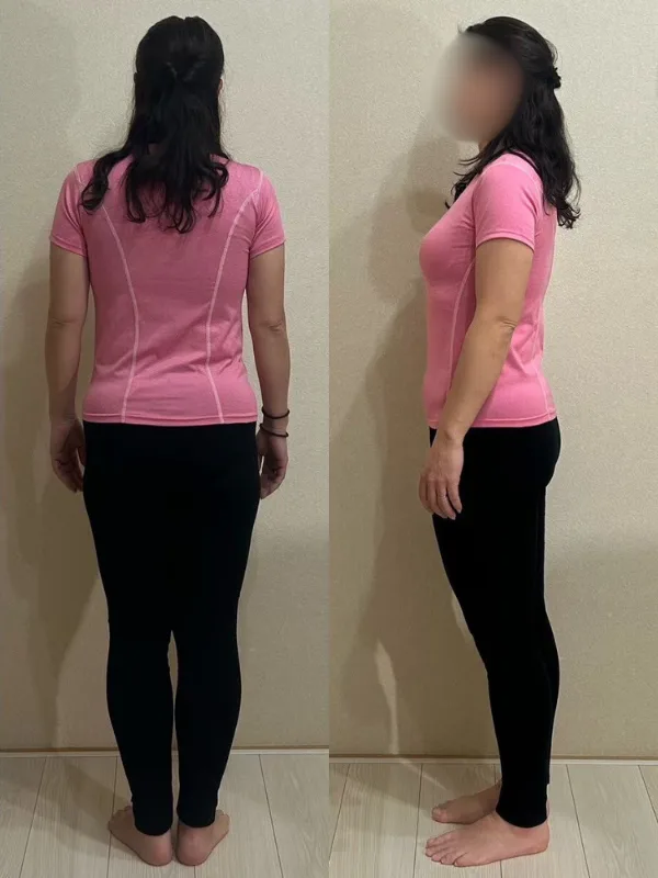 運動もできるようになりました! アフター