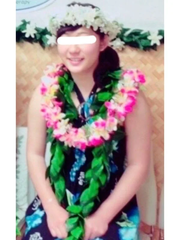 痩せて肌もキレイになりました！ ビフォー