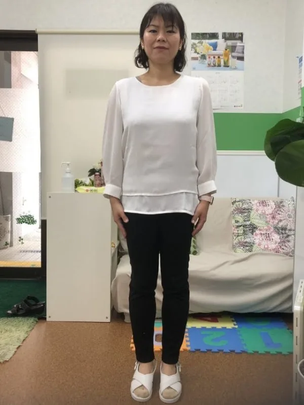 二重アゴがなくなりました！ アフター