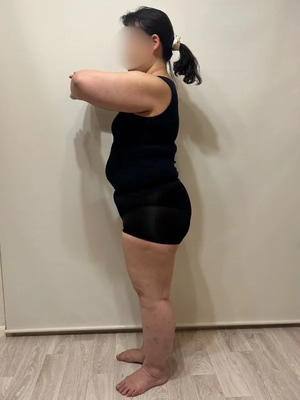 耳つぼダイエットに本当に感謝！ ビフォー