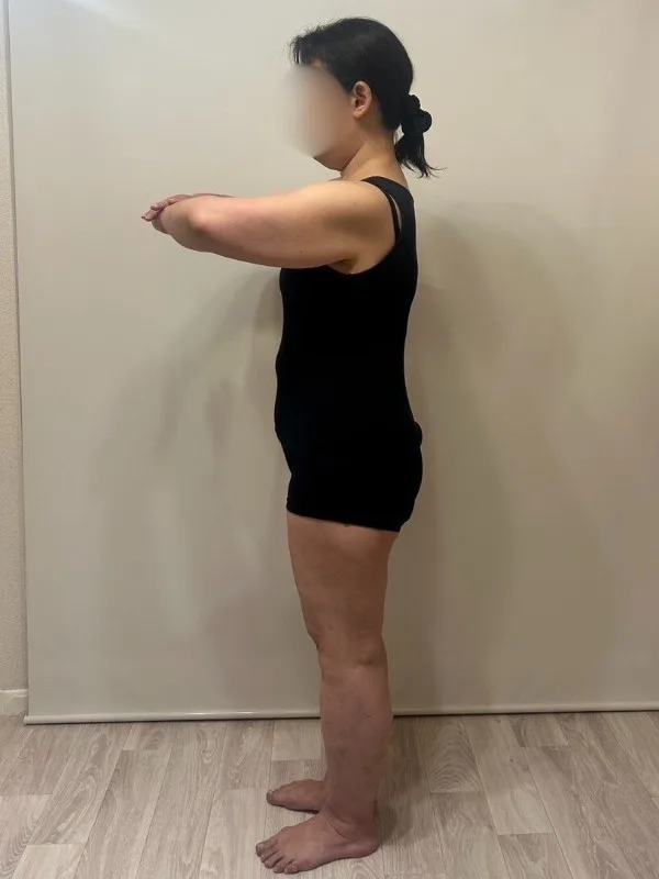 耳つぼダイエットに本当に感謝！ アフター