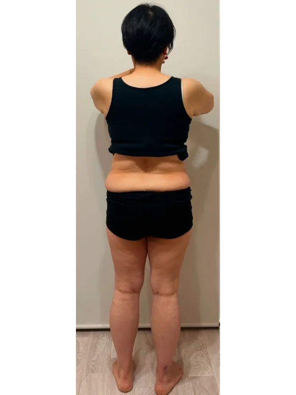 痩せて自信がもてました！ ビフォー