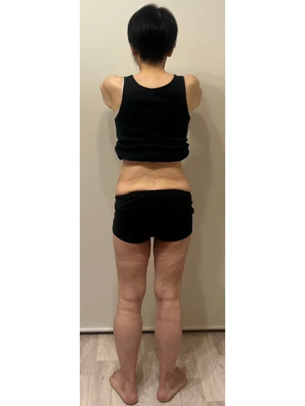 痩せて自信がもてました！ アフター