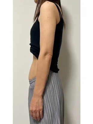 人生最後のダイエット！ アフター