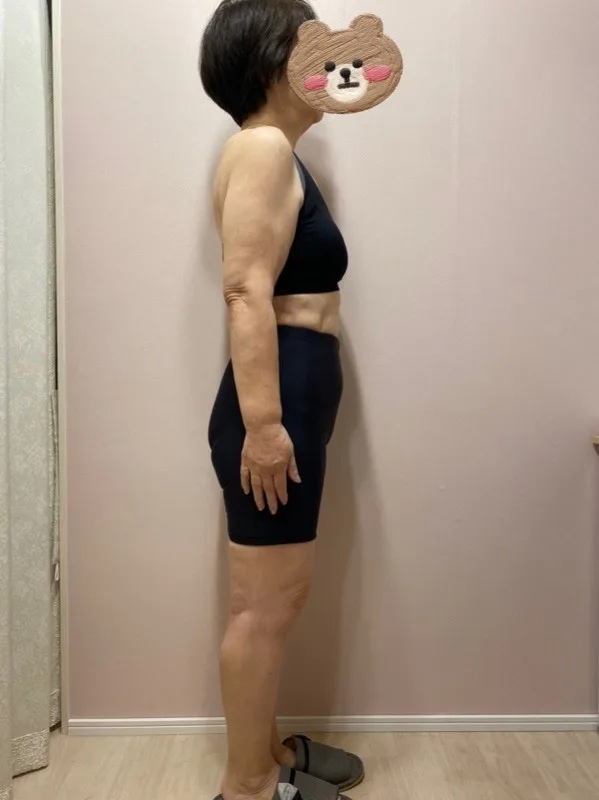 痩せてお医者様が大絶賛！ アフター