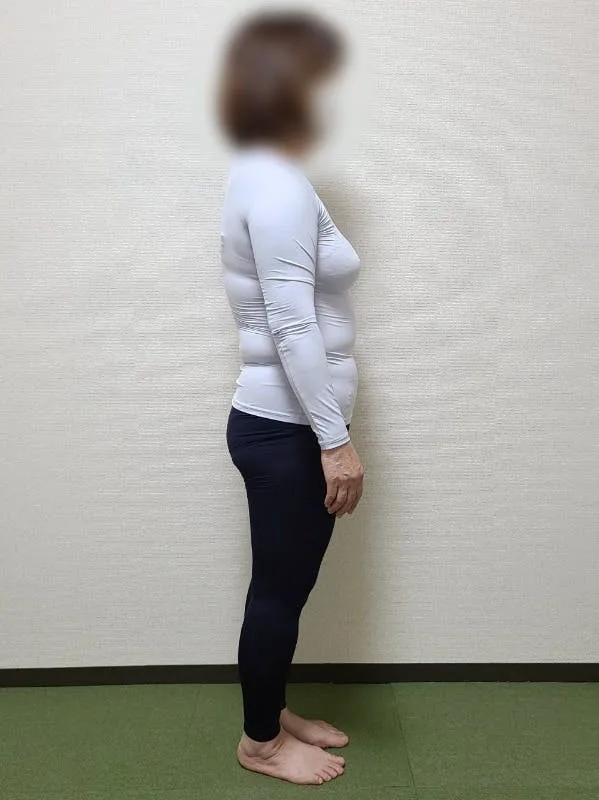 ウエストもスッキリしました！ ビフォー