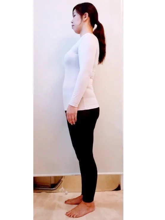 院長の私も大幅ダイエット成功！ ビフォー