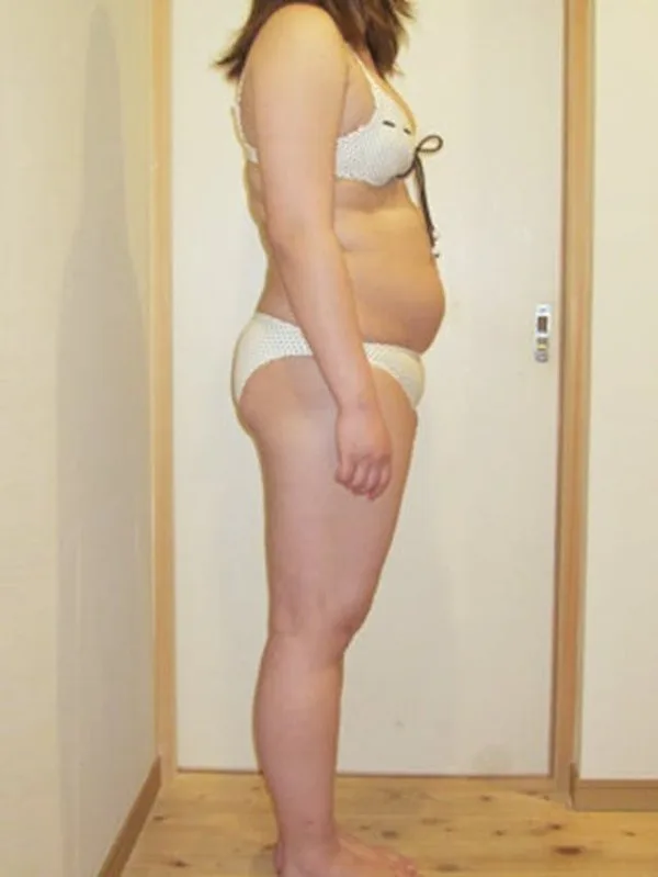 健康的にしっかり痩せました！ ビフォー