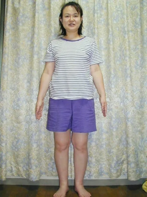 耳つぼダイエットで痩せました！ ビフォー