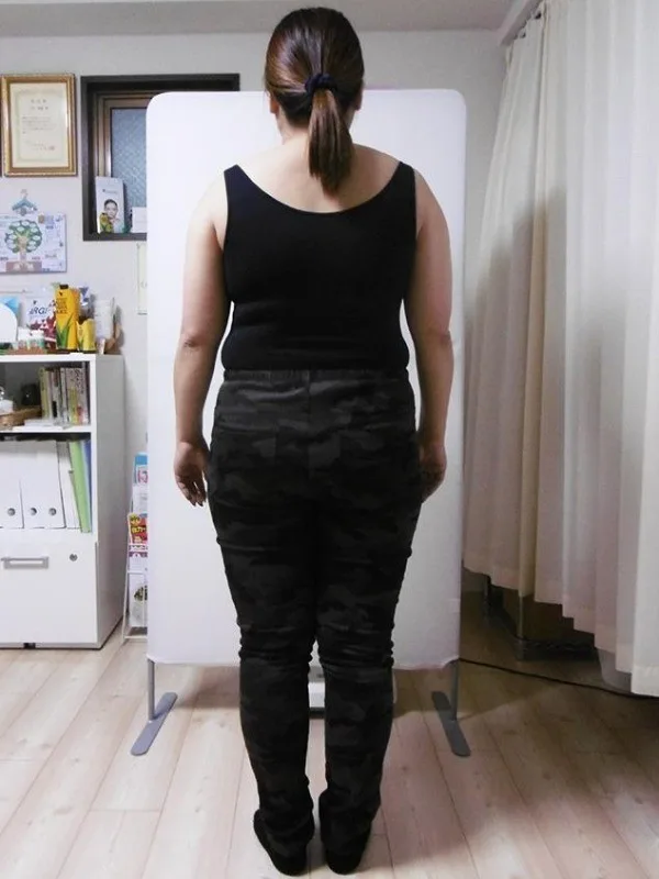 耳ツボダイエットで痩せました！ ビフォー