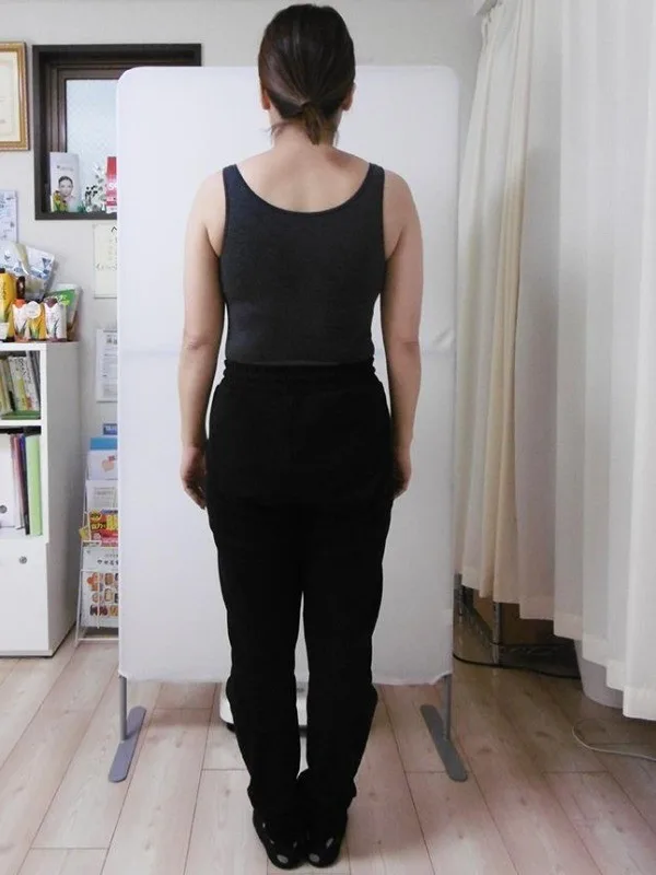 耳ツボダイエットで痩せました！ アフター