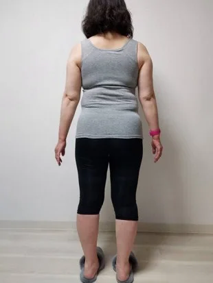 耳ツボダイエットで痩せました! ビフォー