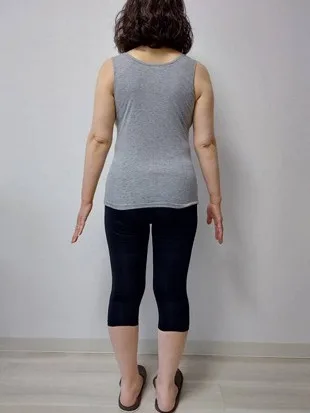 耳ツボダイエットで痩せました! アフター