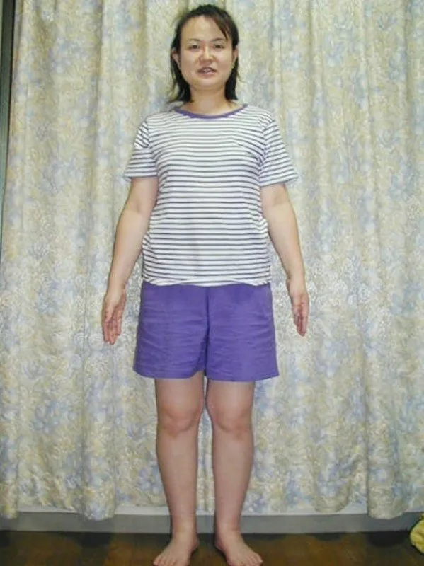 耳ツボダイエットで痩せました！ ビフォー
