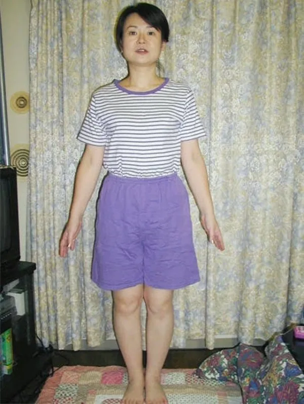 耳ツボダイエットで痩せました！ アフター