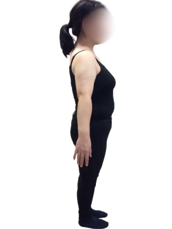 短期間での仰天チェンジ！ ビフォー