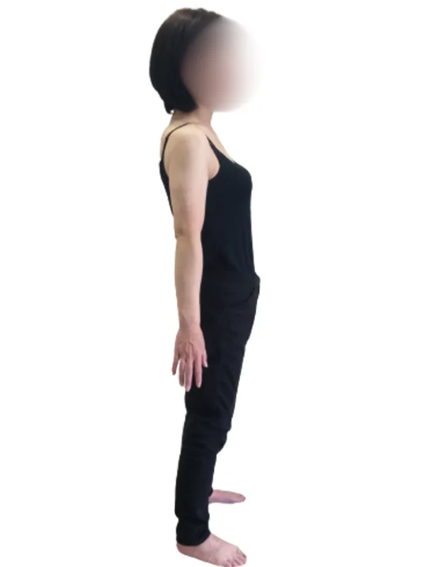 短期間での仰天チェンジ！ アフター