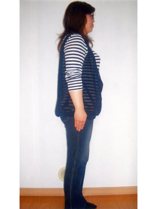 運動なしで楽に痩せられた！ ビフォー