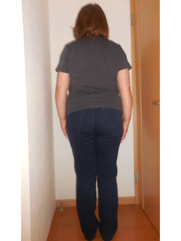 痛みから解放されて階段も楽々！ ビフォー