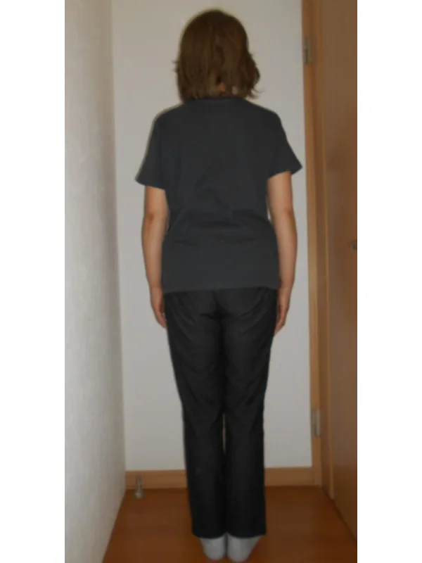 痛みから解放されて階段も楽々！ アフター