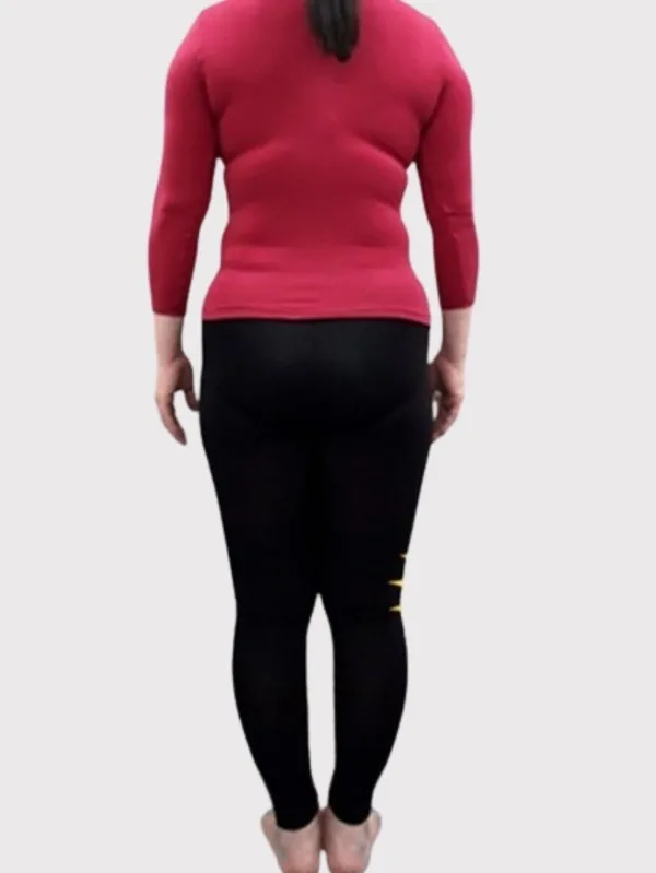 痩せてお肌の調子もよくなった！ ビフォー