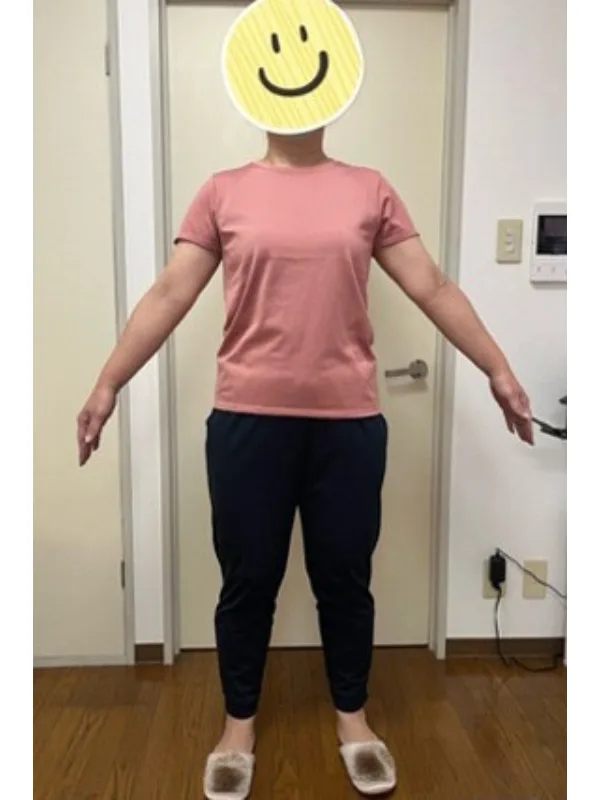 食事のアドバイスで痩せました！ アフター