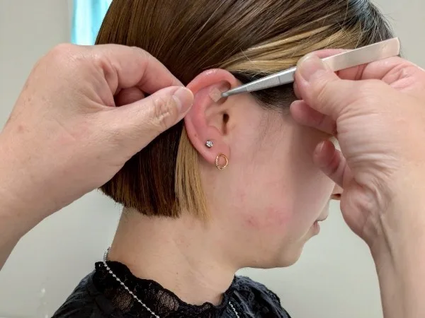 耳ツボダイエットカウンセリング&施術体験