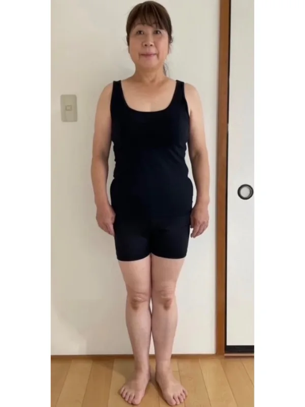 体質改善もできて健康になれた！ ビフォー