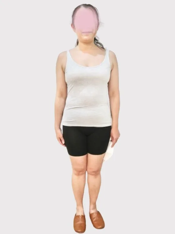 苦労せずにみるみる確実にやせた！ ビフォー