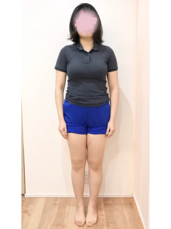 二の腕もほっそり！ダイエット成功！ ビフォー