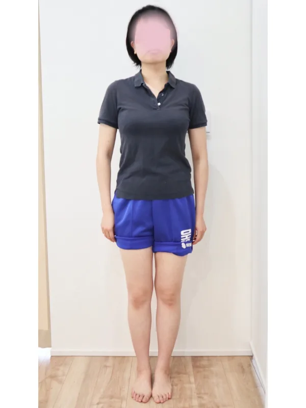 二の腕もほっそり！ダイエット成功！ アフター