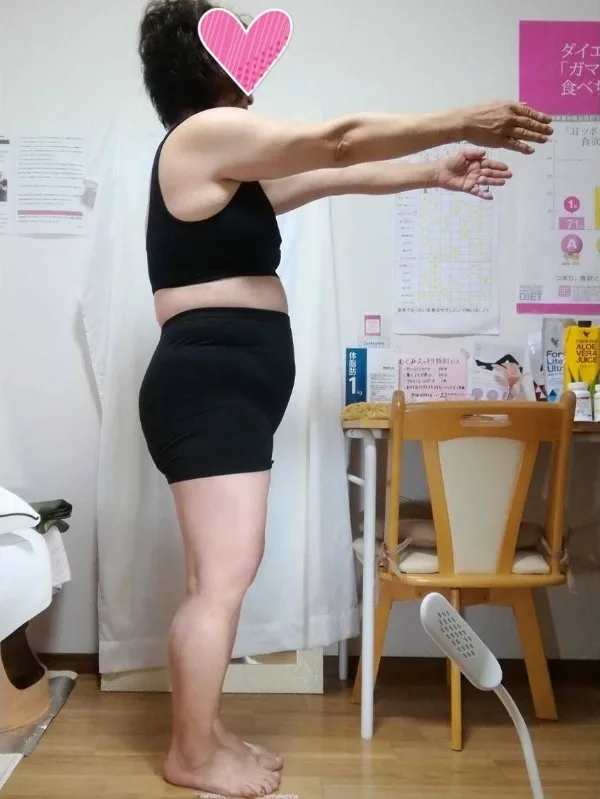 諦めていた服が着られて嬉しい！ ビフォー