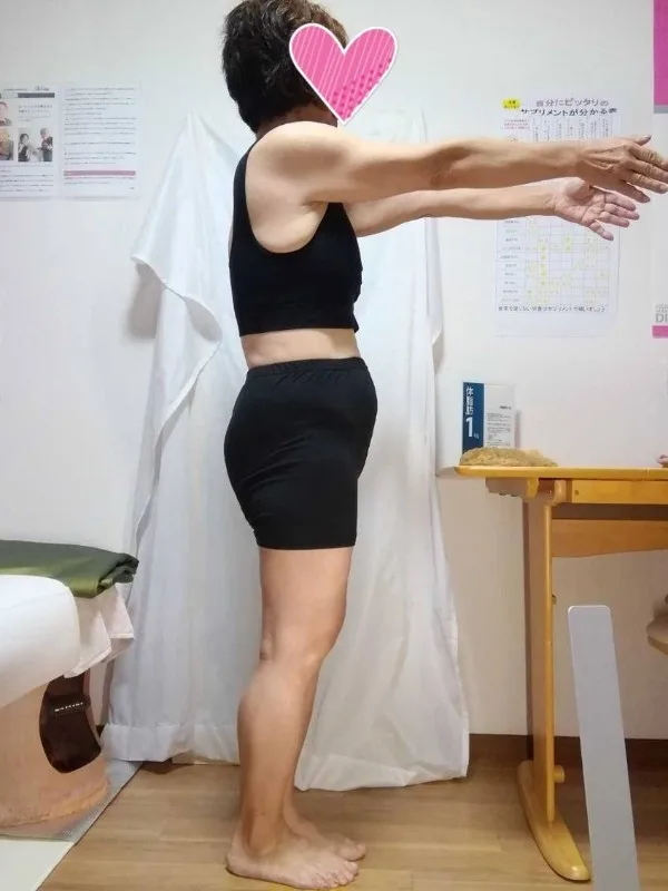 諦めていた服が着られて嬉しい！ アフター