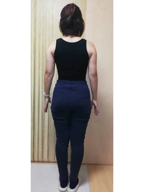 ウエストもスッキリしました！ ビフォー